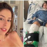 Tras ingerir una sopa instantánea, una mujer de 23 años resultó con parálisis total desde el cuello hasta los pies.