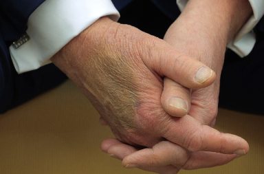 Un moretón en la mano de Donald Trump ha generado especulaciones sobre su salud. La Casa Blanca se pronunció.